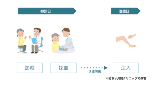 PFC-FD治療の流れ