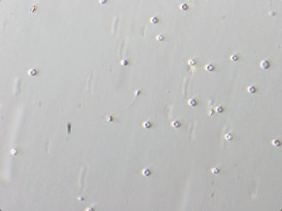 日帰り顕微鏡下精巣精子採取術 山形徳洲会病院 誰もが最善の医療を受けられる社会を目指して